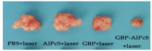 【光电科普知识】能治疗癌症的除了放疗、化疗……还有光！
