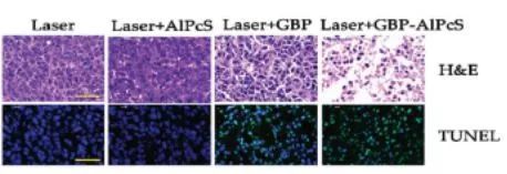 【光电科普知识】能治疗癌症的除了放疗、化疗……还有光！