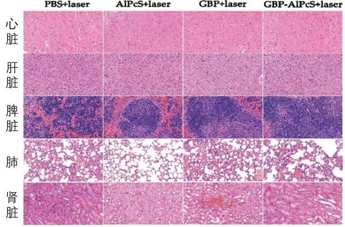 【光电科普知识】能治疗癌症的除了放疗、化疗……还有光！
